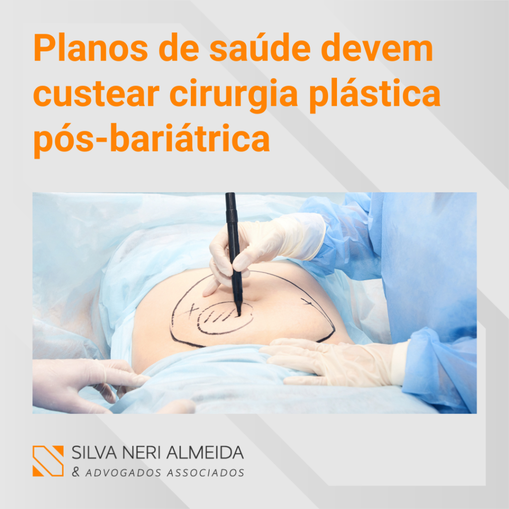 Você sabia que os planos de saúde devem custear cirurgia plástica pós bariátrica?        